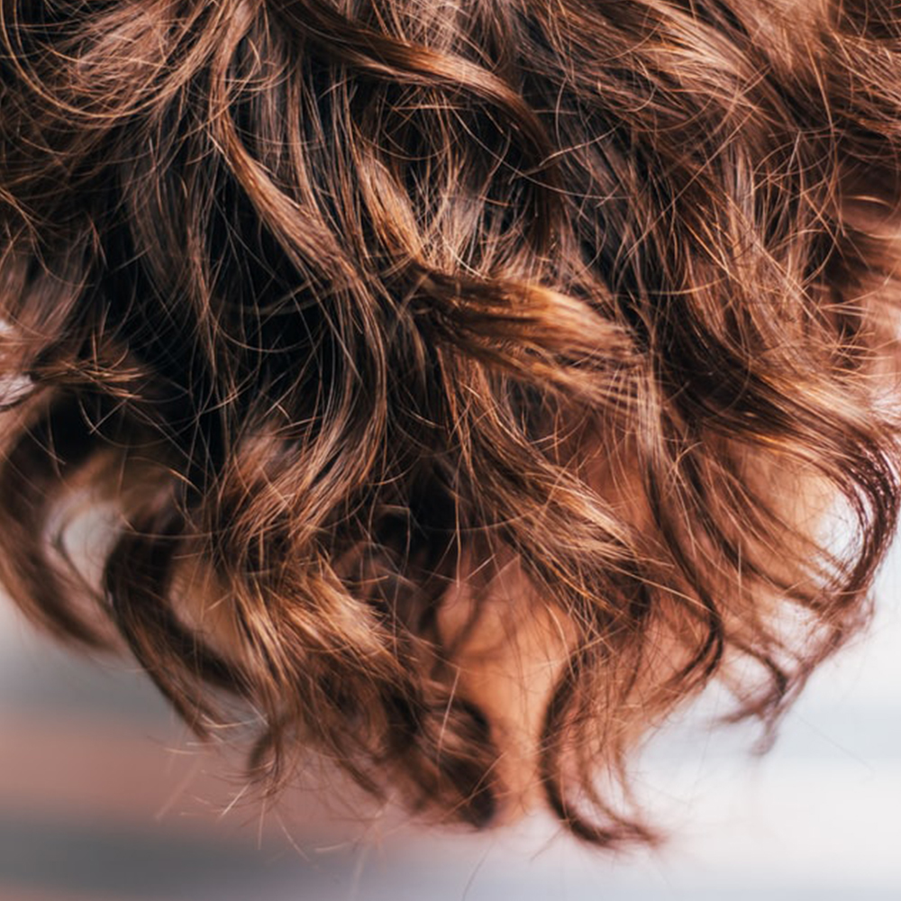 acne (pixabay)